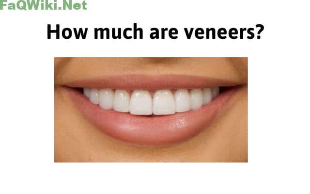 how-much-are-veneers-faqwiki