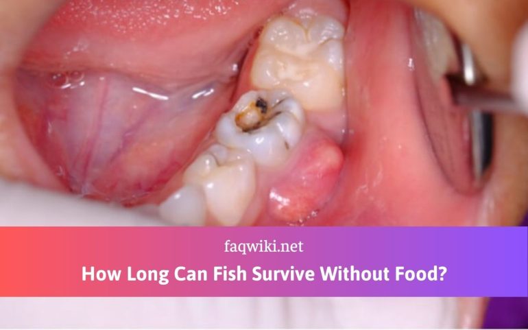 How Long Can a Tooth Infection Go Untreated?