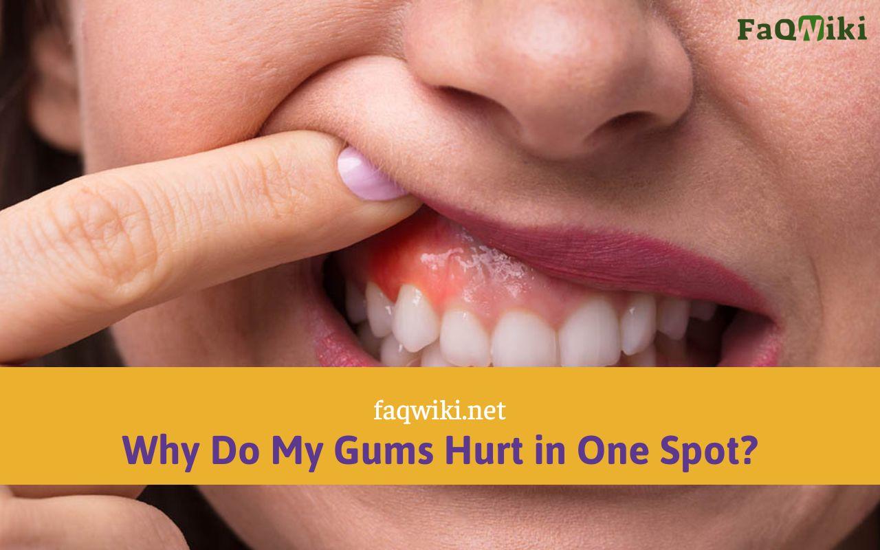 why-do-my-gums-hurt-in-one-spot-faqwiki